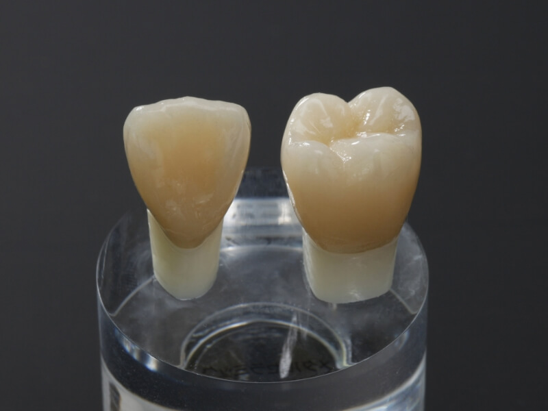 ホームホワイトニング