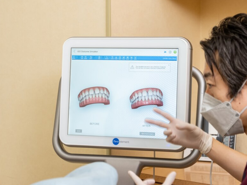精密に診断できるiTeroの導入